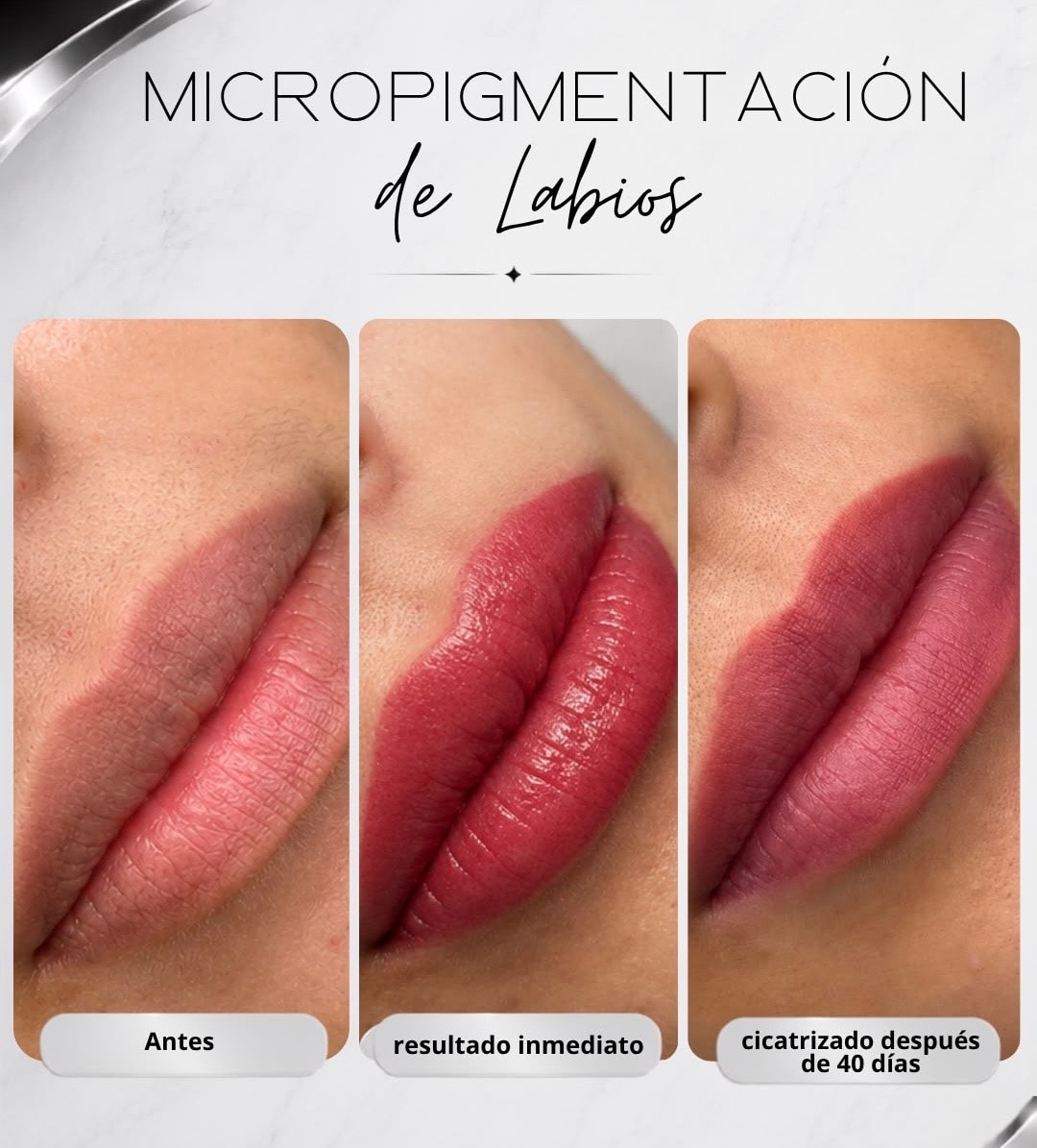 Micropigmentación de Labios — Antes y Después