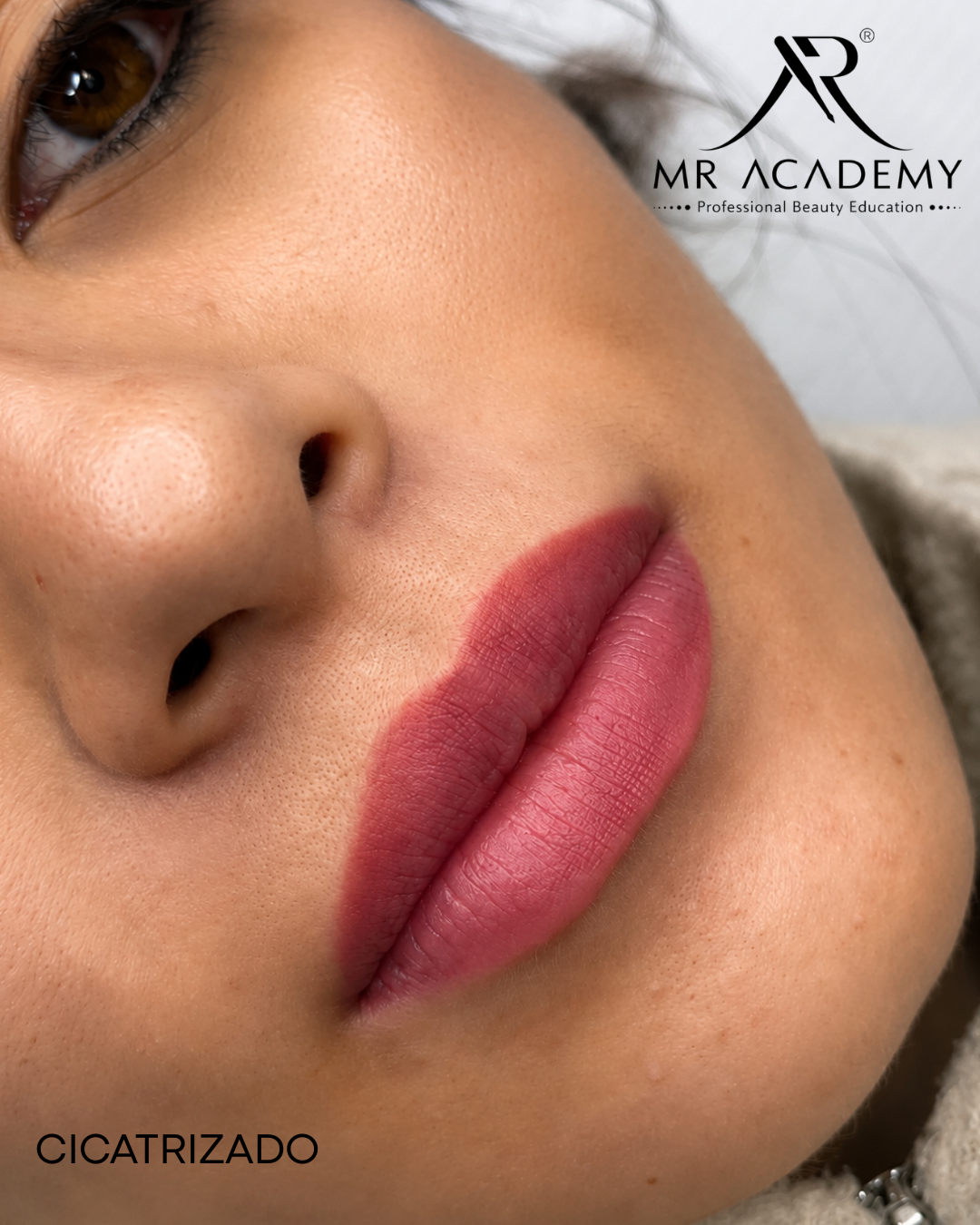 Labios Cicatrizados — Full Lips