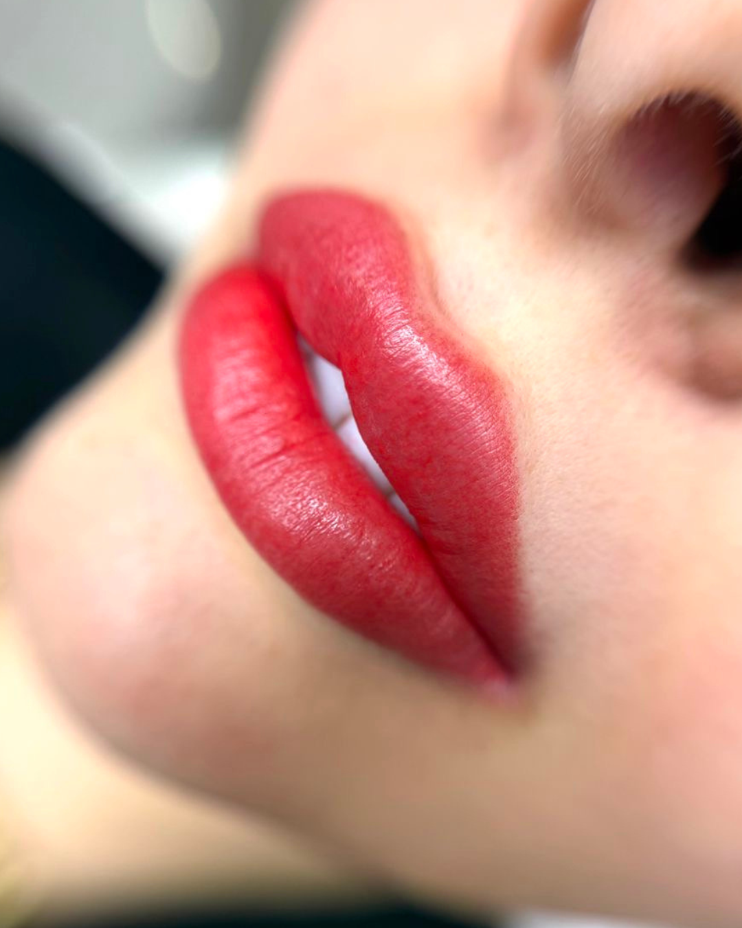 Full Lips