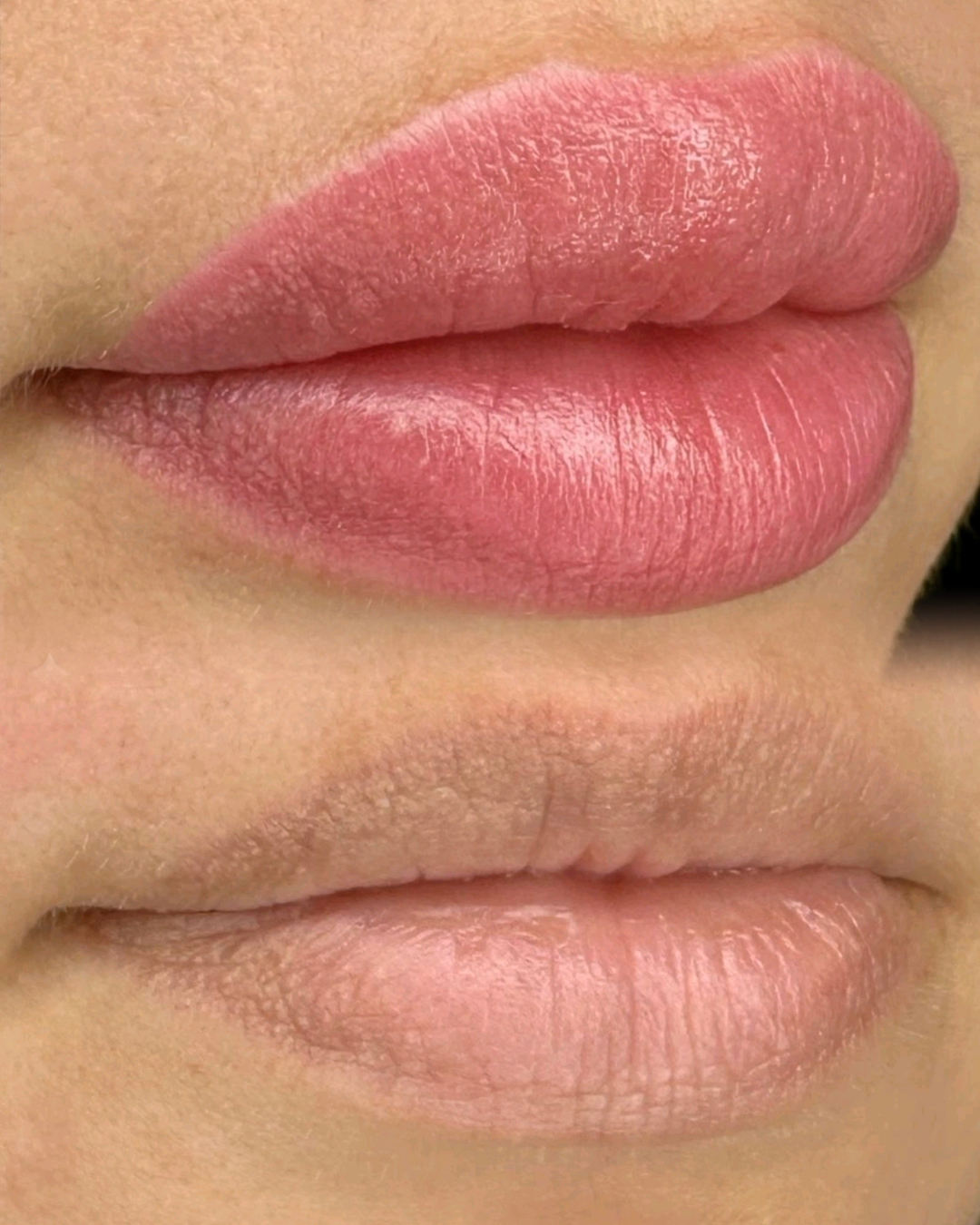 Microlips