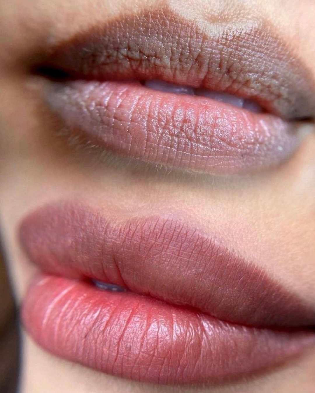Neutralización de labios